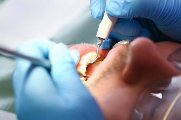 Best Emergency Treatment for Toothache in Harvard, NE